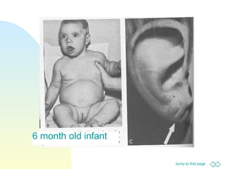 Jump to first page
6 month old infant
 