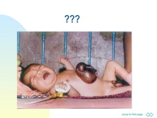 Jump to first page
???
 