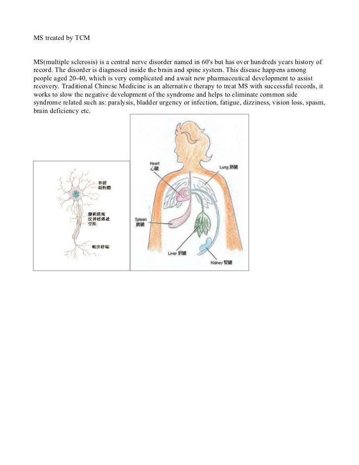 MS treated by TCM