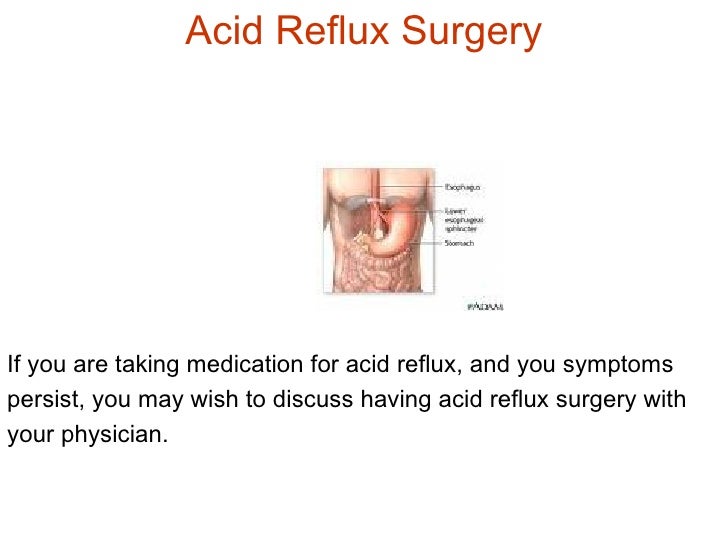 Is Acid Reflux Surgery Right For You?