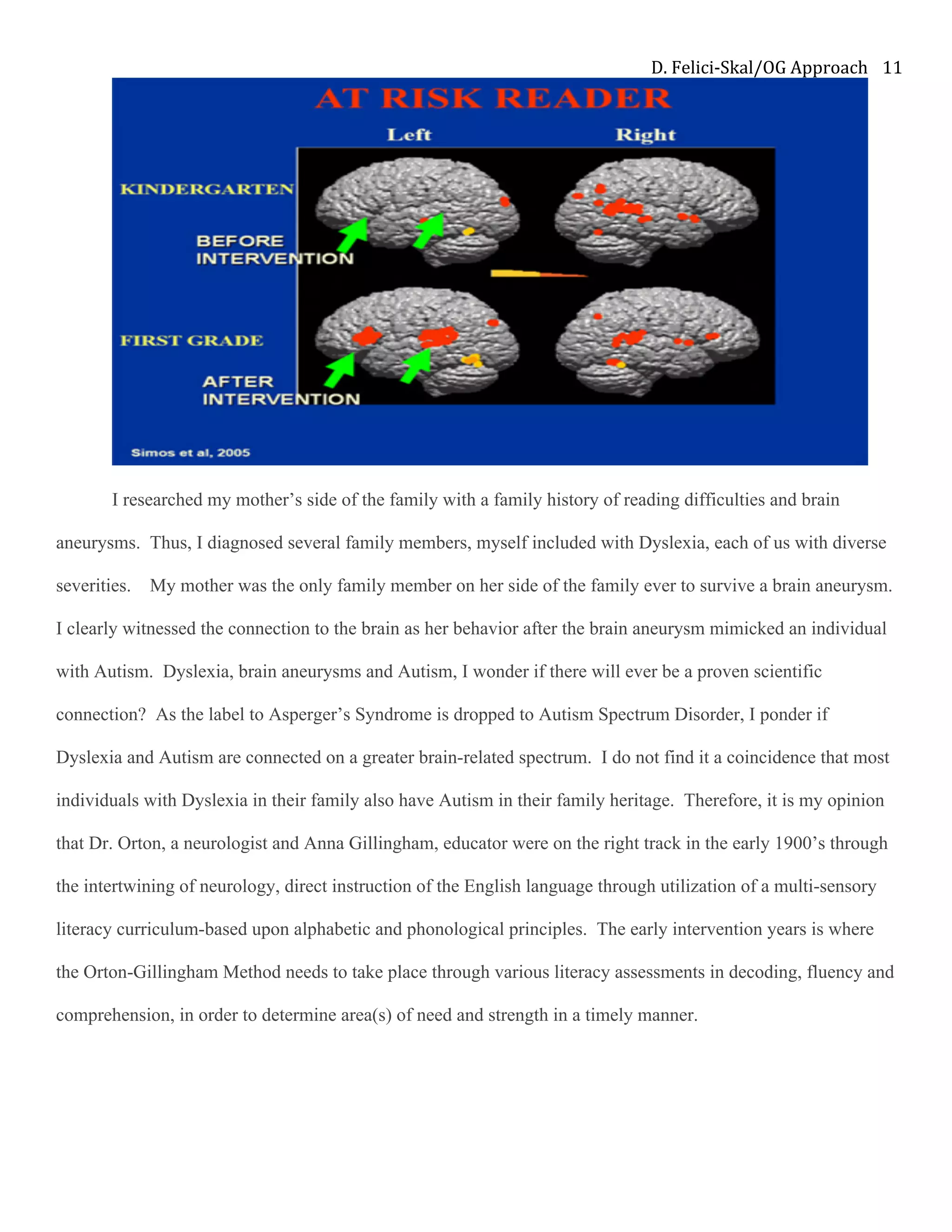 D.	Felici-Skal/OG	Approach	 11	
I researched my mother’s side of the family with a family history of reading difficulties and brain
aneurysms. Thus, I diagnosed several family members, myself included with Dyslexia, each of us with diverse
severities. My mother was the only family member on her side of the family ever to survive a brain aneurysm.
I clearly witnessed the connection to the brain as her behavior after the brain aneurysm mimicked an individual
with Autism. Dyslexia, brain aneurysms and Autism, I wonder if there will ever be a proven scientific
connection? As the label to Asperger’s Syndrome is dropped to Autism Spectrum Disorder, I ponder if
Dyslexia and Autism are connected on a greater brain-related spectrum. I do not find it a coincidence that most
individuals with Dyslexia in their family also have Autism in their family heritage. Therefore, it is my opinion
that Dr. Orton, a neurologist and Anna Gillingham, educator were on the right track in the early 1900’s through
the intertwining of neurology, direct instruction of the English language through utilization of a multi-sensory
literacy curriculum-based upon alphabetic and phonological principles. The early intervention years is where
the Orton-Gillingham Method needs to take place through various literacy assessments in decoding, fluency and
comprehension, in order to determine area(s) of need and strength in a timely manner.
 