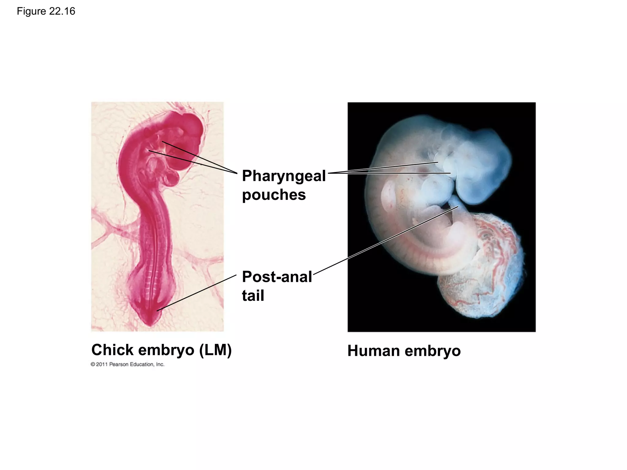Figure 22.16
Pharyngeal
pouches
Post-anal
tail
Chick embryo (LM) Human embryo
 