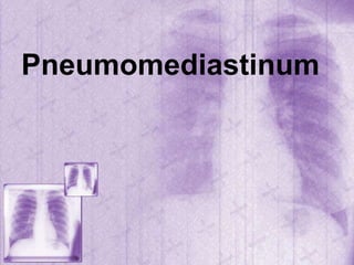 Pneumomediastinum
 