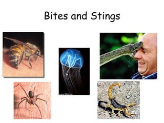 Bites and Stings 