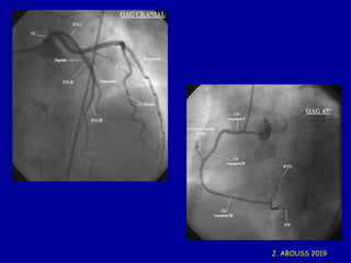 22 Heart EKG (IDM).pdf