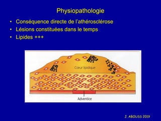 J. ABOUSS 2019
Physiopathologie
• Conséquence directe de l’athérosclérose
• Lésions constituées dans le temps
• Lipides +++
 