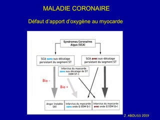 J. ABOUSS 2019
MALADIE CORONAIRE
Défaut d’apport d’oxygène au myocarde
Bio +
Bio -
 