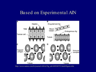 22 kim acute interstitial nephritis | PPT