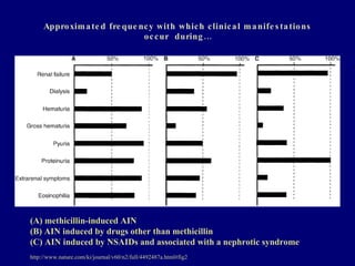 22 kim acute interstitial nephritis | PPT