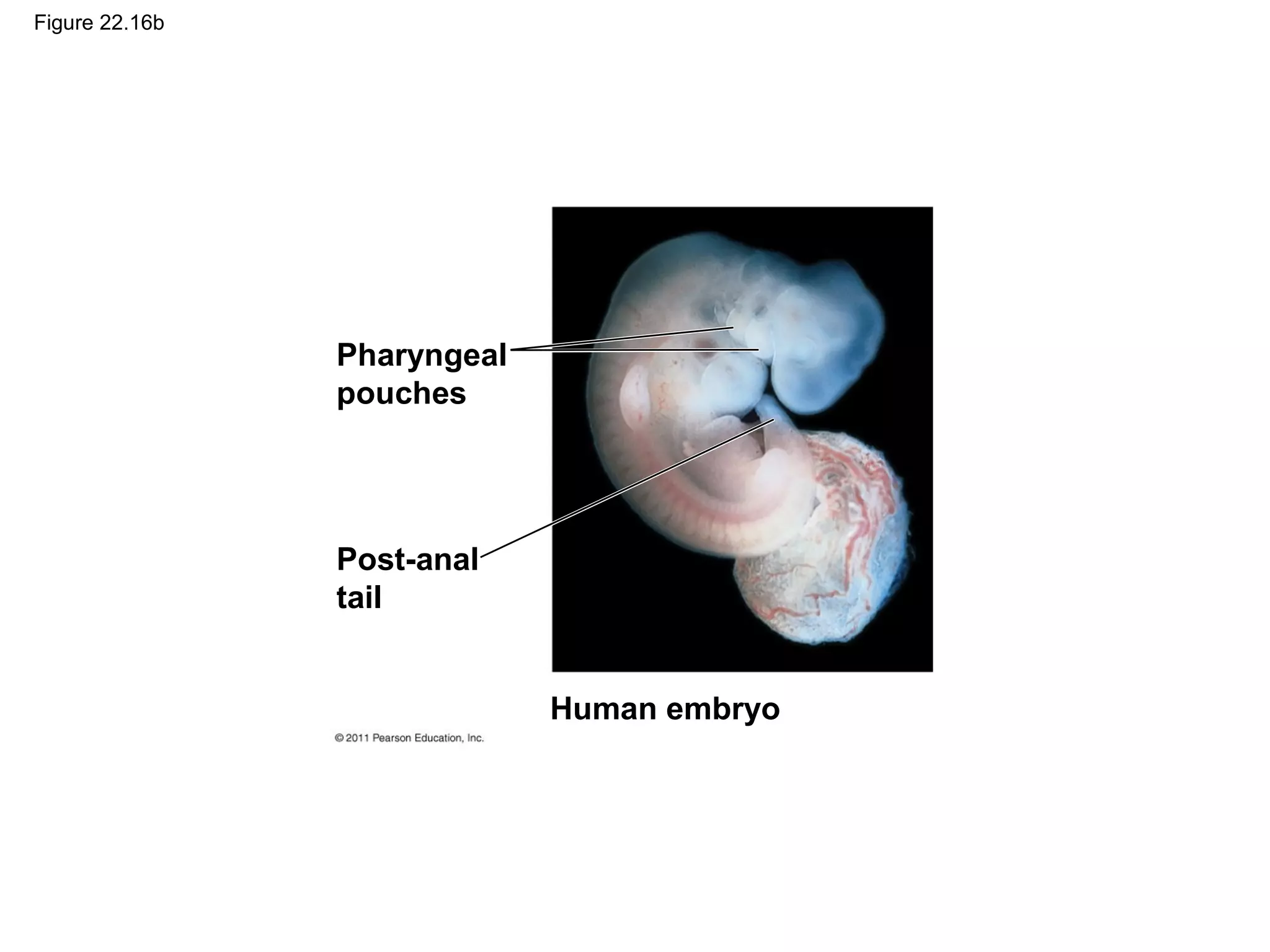 Figure 22.16b
Pharyngeal
pouches
Post-anal
tail
Human embryo
 