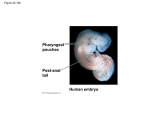 Figure 22.16b
Pharyngeal
pouches
Post-anal
tail
Human embryo
 