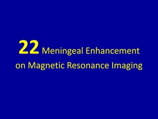 22Meningeal Enhancement
on Magnetic Resonance Imaging
 