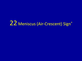 22Meniscus (Air-Crescent) Sign*
 