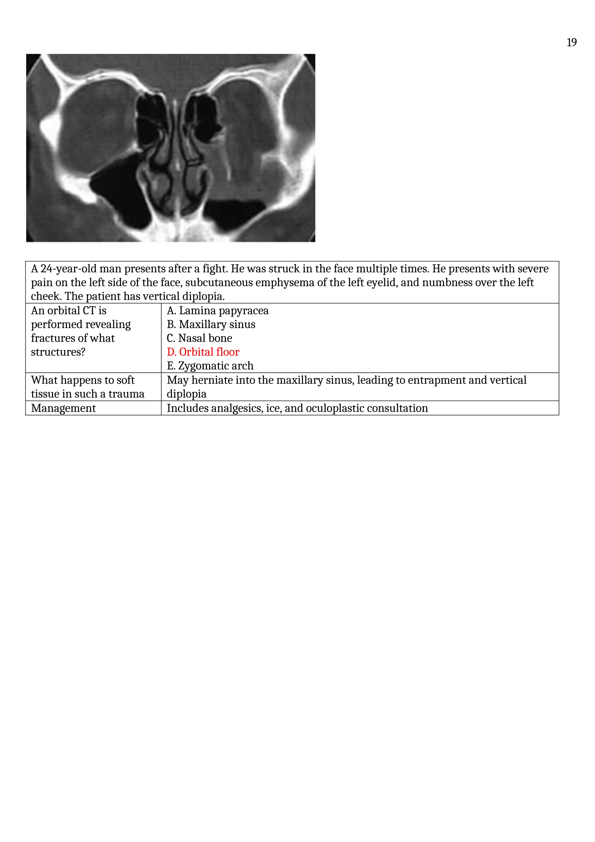 A 24-year-old man presents after a fight. He was struck in the face multiple times. He presents with severe
pain on the left side of the face, subcutaneous emphysema of the left eyelid, and numbness over the left
cheek. The patient has vertical diplopia.
An orbital CT is
performed revealing
fractures of what
structures?
A. Lamina papyracea
B. Maxillary sinus
C. Nasal bone
D. Orbital floor
E. Zygomatic arch
What happens to soft
tissue in such a trauma
May herniate into the maxillary sinus, leading to entrapment and vertical
diplopia
Management Includes analgesics, ice, and oculoplastic consultation
19
 