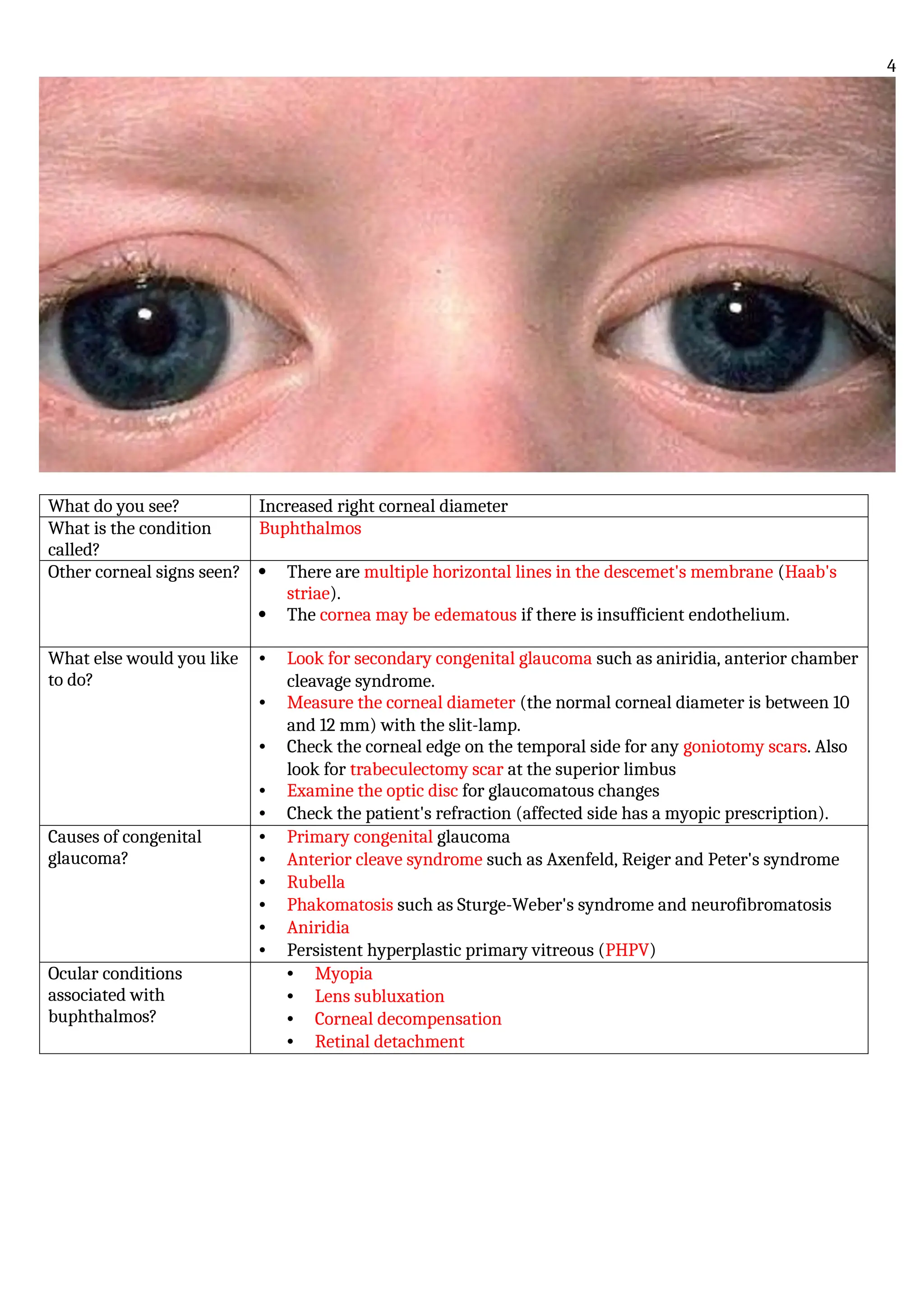 What do you see? Increased right corneal diameter
What is the condition
called?
Buphthalmos
Other corneal signs seen?  There are multiple horizontal lines in the descemet's membrane (Haab's
striae).
 The cornea may be edematous if there is insufficient endothelium.
What else would you like
to do?
• Look for secondary congenital glaucoma such as aniridia, anterior chamber
cleavage syndrome.
• Measure the corneal diameter (the normal corneal diameter is between 10
and 12 mm) with the slit-lamp.
• Check the corneal edge on the temporal side for any goniotomy scars. Also
look for trabeculectomy scar at the superior limbus
• Examine the optic disc for glaucomatous changes
• Check the patient's refraction (affected side has a myopic prescription).
Causes of congenital
glaucoma?
• Primary congenital glaucoma
• Anterior cleave syndrome such as Axenfeld, Reiger and Peter's syndrome
• Rubella
• Phakomatosis such as Sturge-Weber's syndrome and neurofibromatosis
• Aniridia
• Persistent hyperplastic primary vitreous (PHPV)
Ocular conditions
associated with
buphthalmos?
• Myopia
• Lens subluxation
• Corneal decompensation
• Retinal detachment
4
 