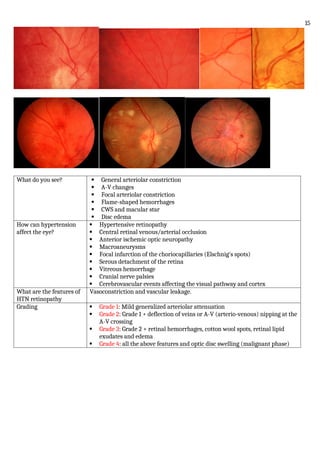What do you see?  General arteriolar constriction
 A-V changes
 Focal arteriolar constriction
 Flame-shaped hemorrhages
 CWS and macular star
 Disc edema
How can hypertension
affect the eye?
 Hypertensive retinopathy
 Central retinal venous/arterial occlusion
 Anterior ischemic optic neuropathy
 Macroaneurysms
 Focal infarction of the choriocapillaries (Elschnig's spots)
 Serous detachment of the retina
 Vitreous hemorrhage
 Cranial nerve palsies
 Cerebrovascular events affecting the visual pathway and cortex
What are the features of
HTN retinopathy
Vasoconstriction and vascular leakage.
Grading  Grade 1: Mild generalized arteriolar attenuation
 Grade 2: Grade 1 + deflection of veins or A-V (arterio-venous) nipping at the
A-V crossing
 Grade 3: Grade 2 + retinal hemorrhages, cotton wool spots, retinal lipid
exudates and edema
 Grade 4: all the above features and optic disc swelling (malignant phase)
15
 