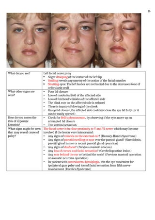 What do you see? Left facial nerve palsy
 Slight drooping of the corner of the left lip
 Smiling reveals asymmetry of the action of the facial muscles
 Shutting eyes: The left lashes are not buried due to the decreased tone of
orbicularis oculi
What other signs are
seen?
• Poor lid closure
• Loss of nasolabial fold of the affected side
• Loss of forehead wrinkles of the affected side
• The blink rate on the affected side is reduced
• There is impaired blowing of the cheek
• On eyelid closure, the affected side could not close the eye lid fully (or it
can be easily opened)
How do you assess the
risk of exposure
keratitis?
• Check for Bell's phenomenon, by observing if the eyes move up on
attempted lid closure
• Test corneal sensation.
What signs might be seen
that may reveal cause of
palsy?
The facial nerve is in close proximity to V and VI nerve which may become
involved if the lesion were intracranial:
• Any signs of vesicles on the external ear? (Ramsey-Hunt's Syndrome)
• Any signs of parotid swelling or scar over the parotid gland? (Sarcoidosis,
parotid gland tumor or recent parotid gland operation)
• Any signs of deafness? (Previous mastoid abscess)
• Any loss of cornea and facial sensation? (Cerebellopontine lesion)
• Any scar behind the ear or behind the neck? (Previous mastoid operation
or acoustic neuroma operation)
• In patient with contralateral hemiplegia, test the eye movement for
ipsilateral gaze palsy and loss of facial sensation from fifth nerve
involvement (Foville's Syndrome)
16
 