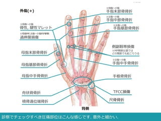 ＜家庭医、総合診療医、救急医のための整形外科的トレーニング＞ 症例22 17F 右手痛