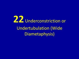 22Underconstriction or
Undertubulation (Wide
Diametaphysis)
 