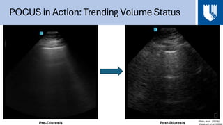 Reviving the Physical Exam: The POCUS Volume Assessment | PDF