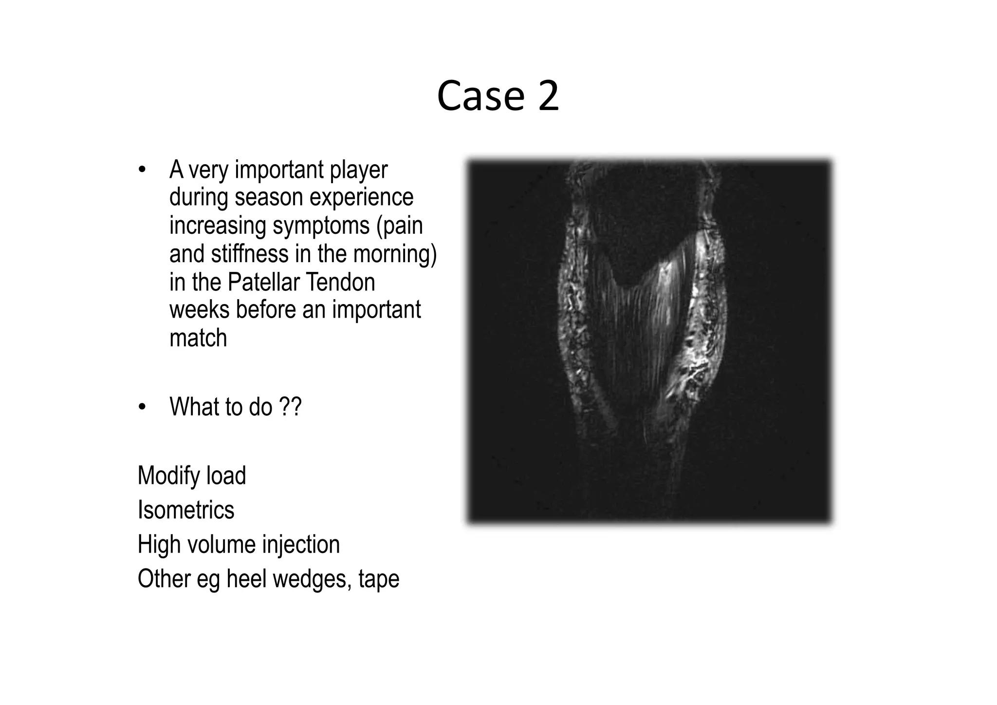 Case	
  2	
  
•  A very important player
during season experience
increasing symptoms (pain
and stiffness in the morning)
in the Patellar Tendon
weeks before an important
match
•  What to do ??
Modify load
Isometrics
High volume injection
Other eg heel wedges, tape

 