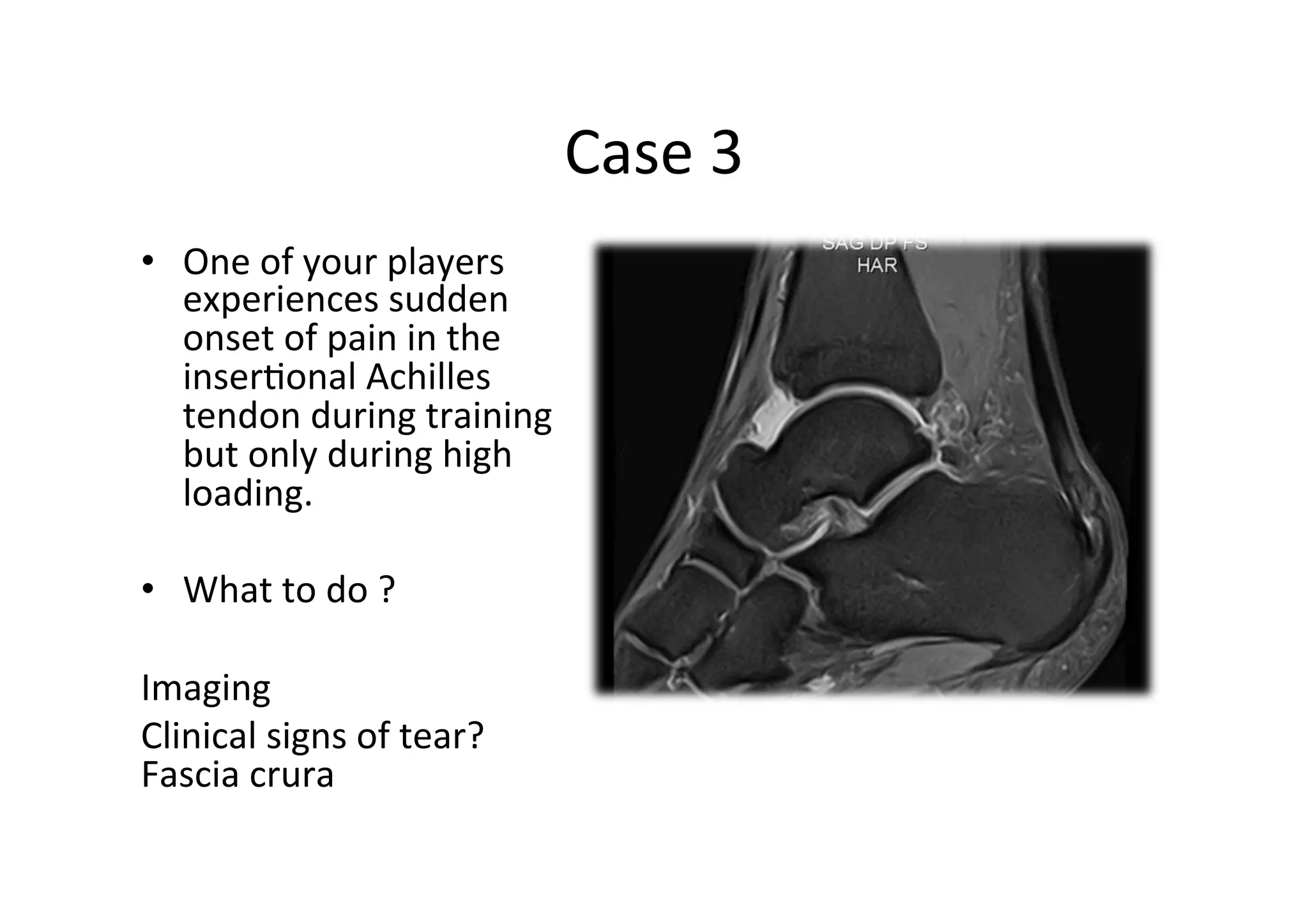 Case	
  3	
  
•  One	
  of	
  your	
  players	
  
experiences	
  sudden	
  
onset	
  of	
  pain	
  in	
  the	
  
inser;onal	
  Achilles	
  
tendon	
  during	
  training	
  
but	
  only	
  during	
  high	
  
loading.	
  
•  What	
  to	
  do	
  ?	
  
	
  
Imaging	
  
Clinical	
  signs	
  of	
  tear?	
  
Fascia	
  crura	
  
	
  

 