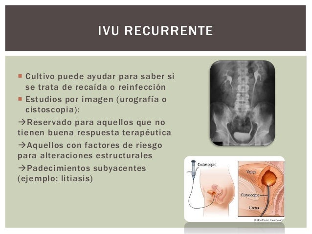 23. GPC IVU 23. GPC IVU