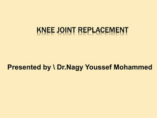 KNEE JOINT REPLACEMENT
Presented by  Dr.Nagy Youssef Mohammed
 