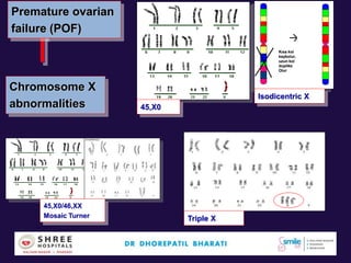 Chromosome X
abnormalities 45,X0
Kısa kol
kaybolur,
uzun kol
duplike
Olur
Isodicentric X
Triple X
45,X0/46,XX
Mosaic Turner
Premature ovarian
failure (POF)
 