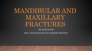 MANDIBULAR AND
MAXILLARY
FRACTURES
DR. HADI MUNIB
ORAL AND MAXILLOFACIAL SURGERY RESIDENT
 