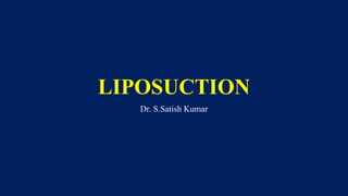 LIPOSUCTION
Dr. S.Satish Kumar
 