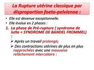 La Rupture utérine classique par
disproportion foeto-pelvienne :
• Elle est devenue exceptionnelle.
• Elle évolue en 2 phases :
1. La phase de Pré-rupture ( syndrome de
lutte = SYNDROME DE BANDEL FROMMEL)
:
 Après un travail prolongé;
 Des contractions utérines de plus en plus
rapprochées avec une mauvaise
relâchement intercalaire :
 