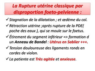 La Rupture utérine classique par
disproportion foeto-pelvienne :
Stagnation de la dilatation ; et œdème du col.
Rétraction utérine ;après rupture de la PDE(
poche des eaux ), qui se moule sur le foetus.
Étirement du segment inférieur => formation d
un Anneau de Bandel : Utérus en Sablier +++.
Tension douloureuse des ligaments ronds en
cordes de violon.
La patiente est Très agitée et anxieuse.
 