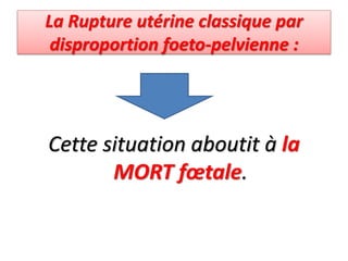 La Rupture utérine classique par
disproportion foeto-pelvienne :
Cette situation aboutit à la
MORT fœtale.
 