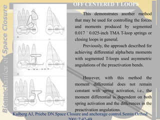 Biomechanics of Space Closure | PPT