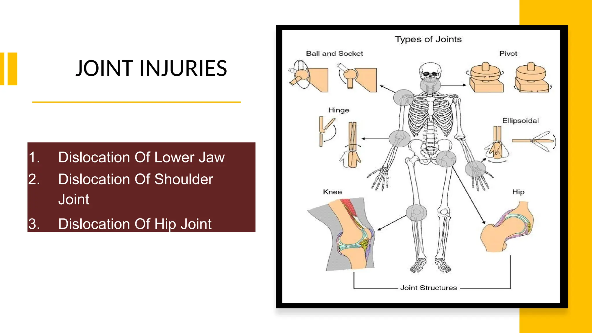 JOINT INJURIES
1. Dislocation Of Lower Jaw
2. Dislocation Of Shoulder
Joint
3. Dislocation Of Hip Joint
 