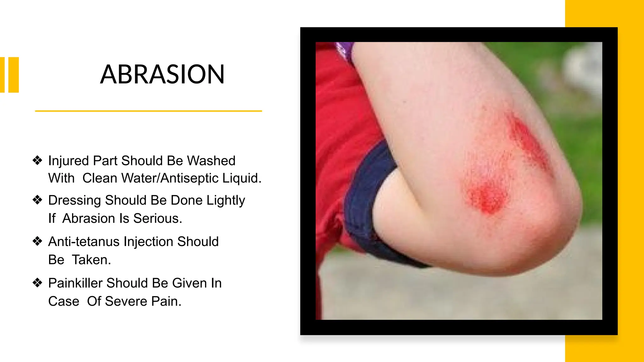 ABRASION
❖ Injured Part Should Be Washed
With Clean Water/Antiseptic Liquid.
❖ Dressing Should Be Done Lightly
If Abrasion Is Serious.
❖ Anti-tetanus Injection Should
Be Taken.
❖ Painkiller Should Be Given In
Case Of Severe Pain.
 
