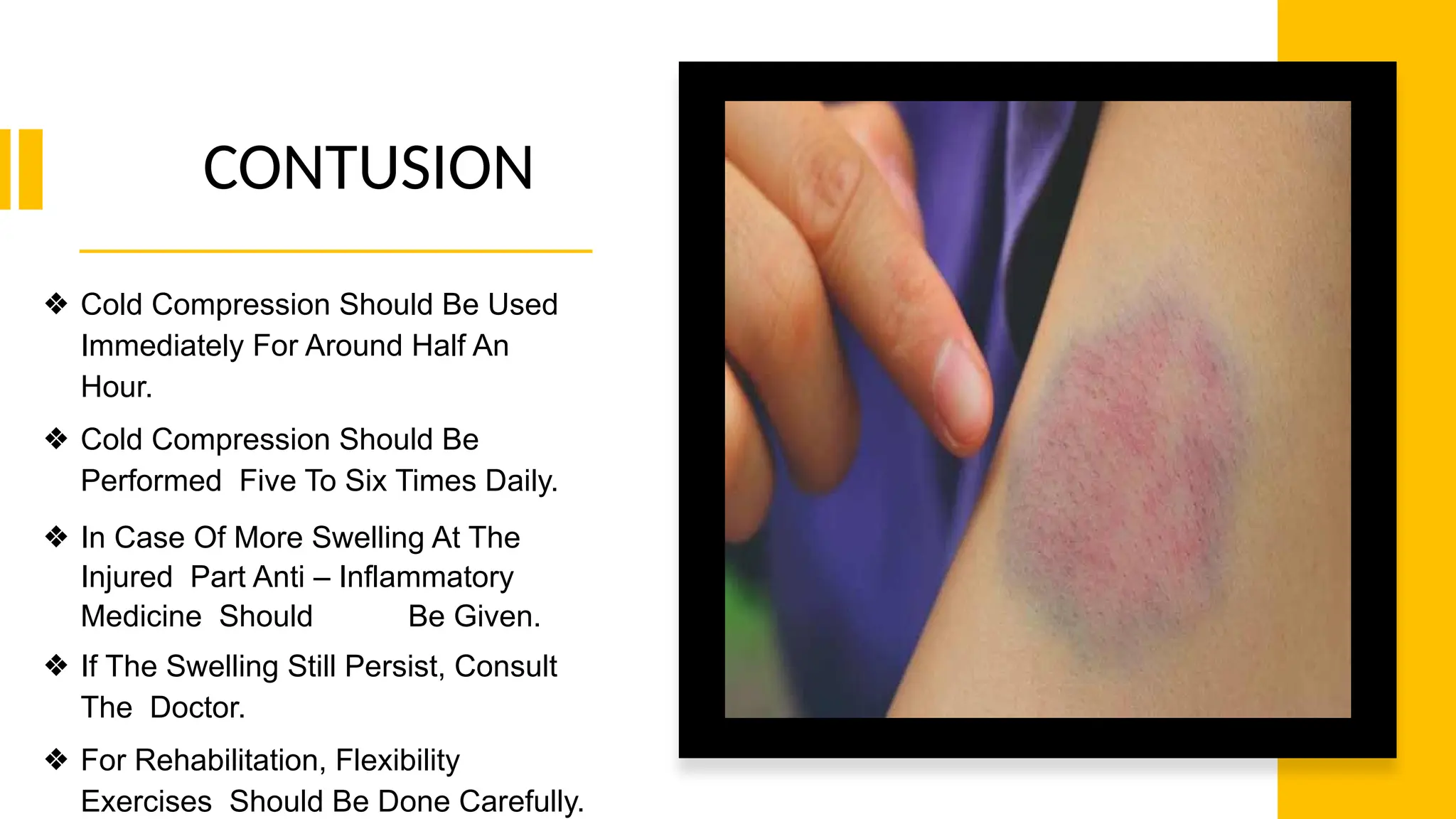 CONTUSION
❖ Cold Compression Should Be Used
Immediately For Around Half An
Hour.
❖ Cold Compression Should Be
Performed Five To Six Times Daily.
❖ In Case Of More Swelling At The
Injured Part Anti – Inflammatory
Medicine Should Be Given.
❖ If The Swelling Still Persist, Consult
The Doctor.
❖ For Rehabilitation, Flexibility
Exercises Should Be Done Carefully.
 