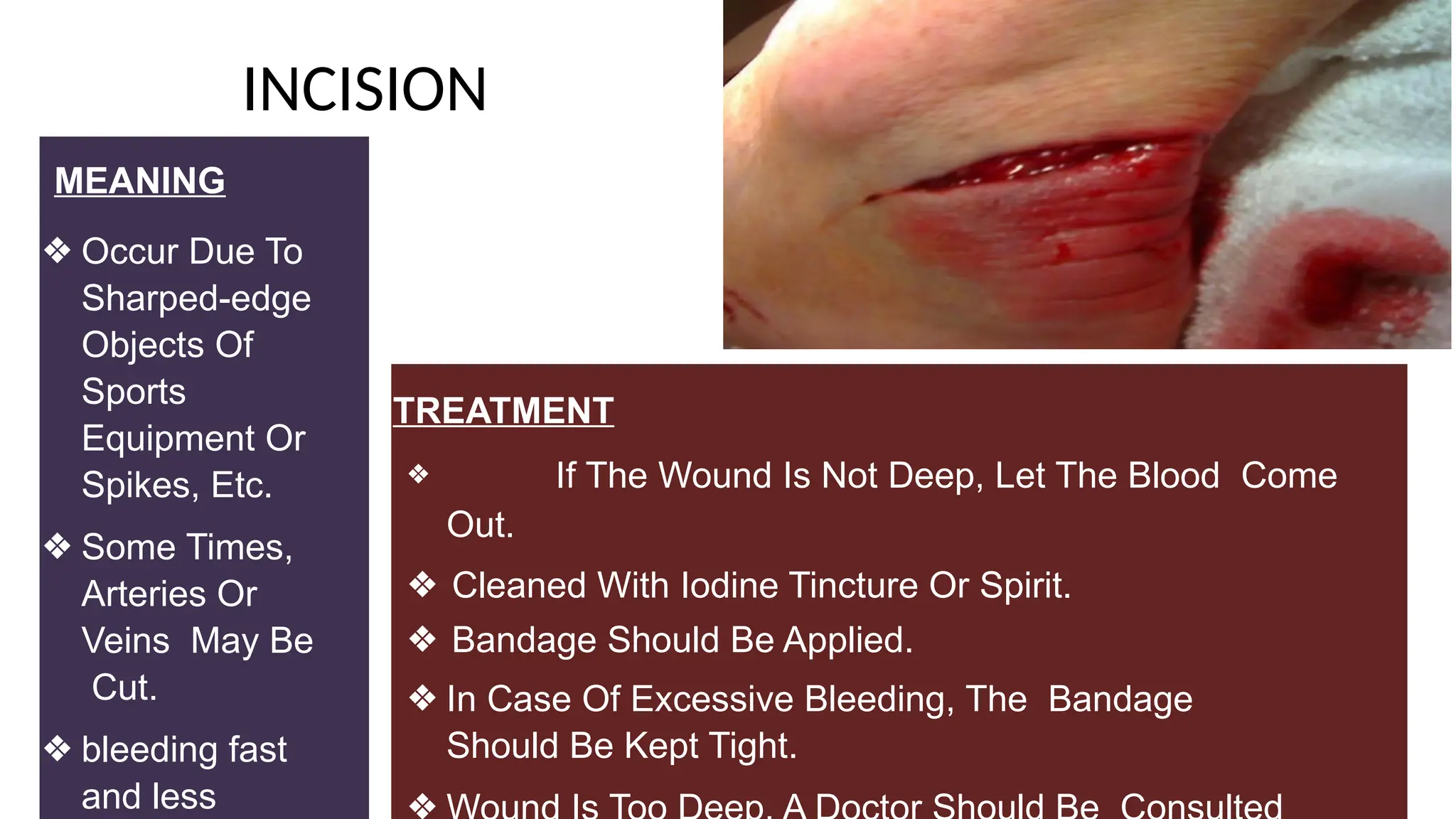 INCISION
MEANING
❖ Occur Due To
Sharped-edge
Objects Of
Sports
Equipment Or
Spikes, Etc.
❖ Some Times,
Arteries Or
Veins May Be
Cut.
❖ bleeding fast
and less
TREATMENT
❖ If The Wound Is Not Deep, Let The Blood Come
Out.
❖ Cleaned With Iodine Tincture Or Spirit.
❖ Bandage Should Be Applied.
❖ In Case Of Excessive Bleeding, The Bandage
Should Be Kept Tight.
 