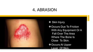 Physiology and injuries in sports class 12th | PPTX