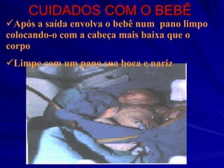 CUIDADOS COM O BEBÊ Após a saída envolva o bebê num  pano limpo colocando-o com a cabeça mais baixa que o corpo Limpe com um pano sua boca e nariz 