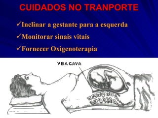 CUIDADOS NO TRANPORTE Inclinar a gestante para a esquerda Monitorar sinais vitais Fornecer Oxigenoterapia 