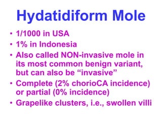 Hydatidiform Mole 
• 1/1000 in USA 
• 1% in Indonesia 
• Also called NON-invasive mole in 
its most common benign variant, 
but can also be “invasive” 
• Complete (2% chorioCA incidence) 
or partial (0% incidence) 
• Grapelike clusters, i.e., swollen villi 
 