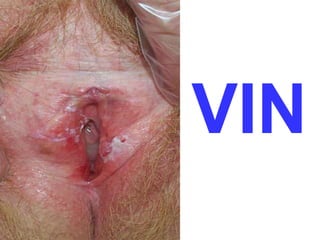 VIN 
 