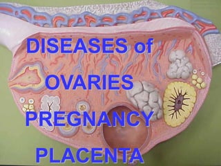 DISEASES of 
OVARIES 
PREGNANCY 
PLACENTA 
 
