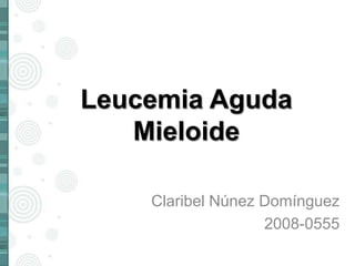 Leucemia Aguda
Mieloide
Claribel Núnez Domínguez
2008-0555
 