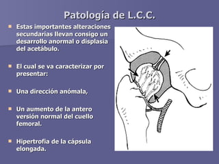 Patología de L.C.C. <ul><li>Estas importantes alteraciones secundarias llevan consigo un desarrollo anormal o displasia de...