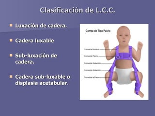 Clasificación de L.C.C. <ul><li>Luxación de cadera. </li></ul><ul><li>Cadera luxable </li></ul><ul><li>Sub-luxación de cad...