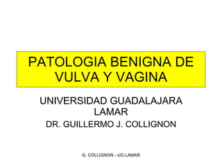 PATOLOGIA BENIGNA DE VULVA Y VAGINA UNIVERSIDAD GUADALAJARA LAMAR DR. GUILLERMO J. COLLIGNON G. COLLIGNON - UG LAMAR 