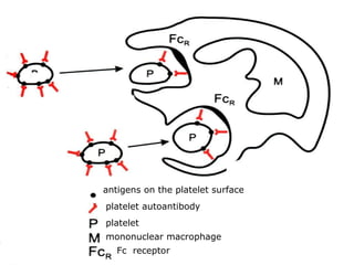 antigens on the platelet surface platelet autoantibody platelet mononuclear macrophage Fc  receptor 